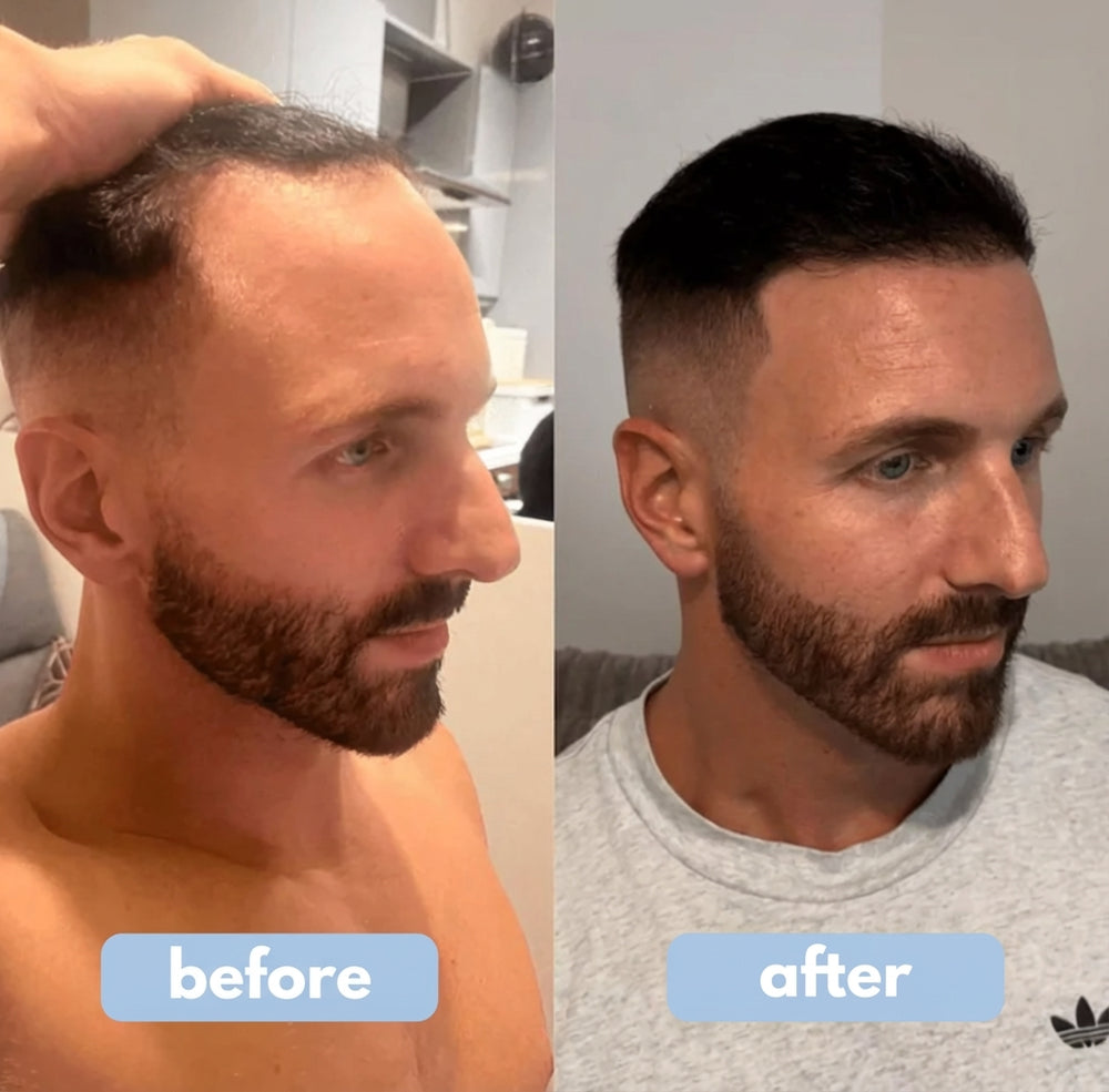 Bodywise Hairgrowth Serum image Bodywise Hairgrowth Serum